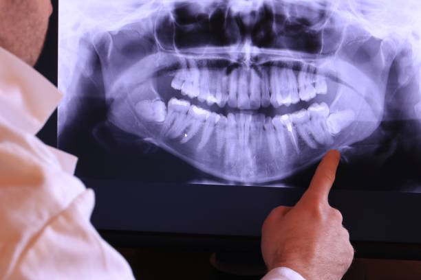 Best Broken or Cracked Tooth Emergency Dentist in Kulpmont, PA
