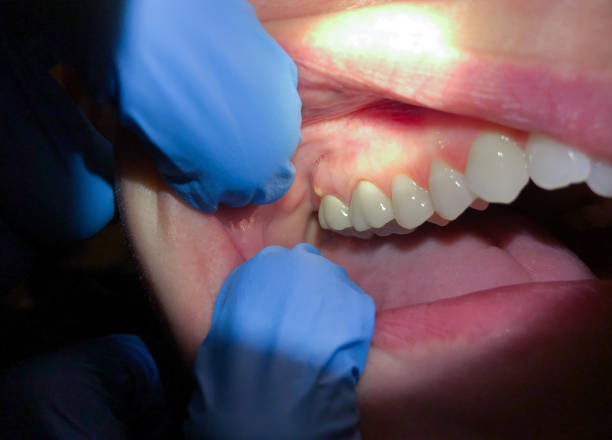 Best Emergency Dentist for Special Needs Patients in Kulpmont, PA